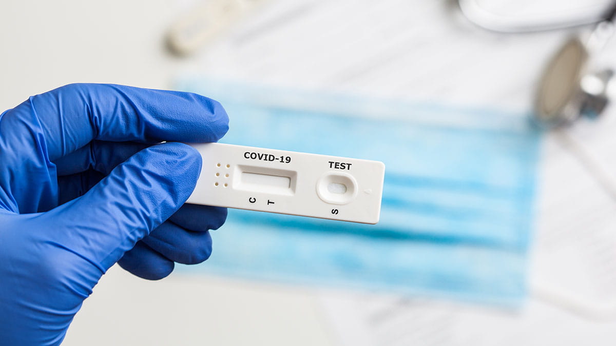 Covid-19 Rapid Anti-gen Test